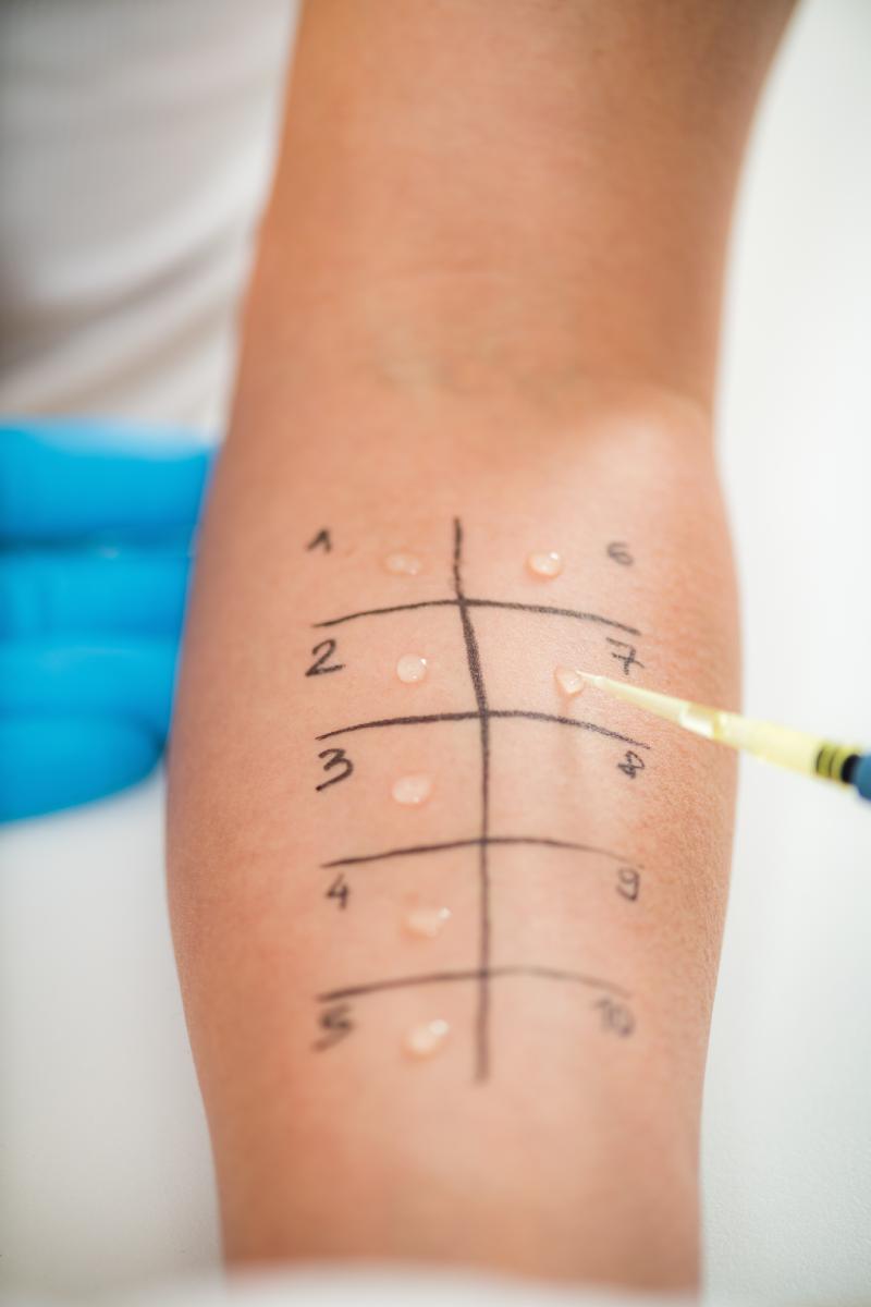 Allergies, Allergy Services, Allergy Relief, Precision Allergen Testing, Seasonal Allergy Support